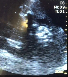 Gorilla Infant Ultrasound