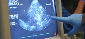 Gorilla Infant Ultrasound